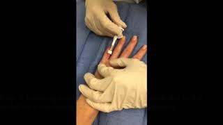 Hand Rejuvenation | Anup Patel, MD, MBA, FACS