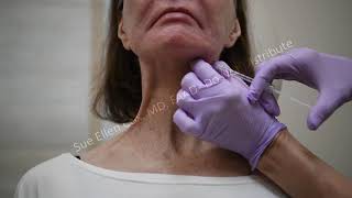 Neck Bands | Sue Ellen Cox, MD, FAAD