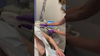 Non-Surgical Arm Rejuvenation 1 | Rosa Sanchez, MA, AS