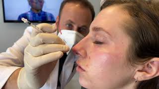 Nose | Alexander Z. Rivkin, MD