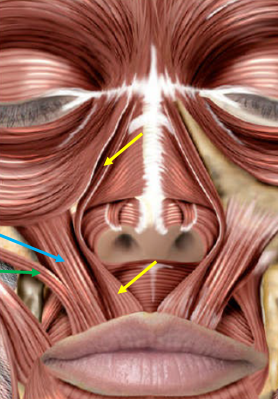 Figure 9: Muscles involved when addressing a gummy smile. The LLSAN (yellow arrows) is the primary target. Secondary targets that can be considered in select circumstances include the, LLS (blue), and the zygomaticus major and minor muscles (green). Injections to the depressor septi nasi can be considered centrally (not pictured) to lengthen the upper cutaneous lip and lift the nasal tip. Figures reproduced courtesy of André Braz, Atlas de Anatomia e Preenchimento Global da Face.