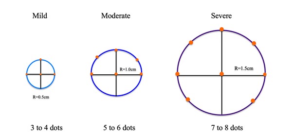 Figure 3: Demarcation of the treatment area and injection sites. Dots represent planned injection sites. R, radius.