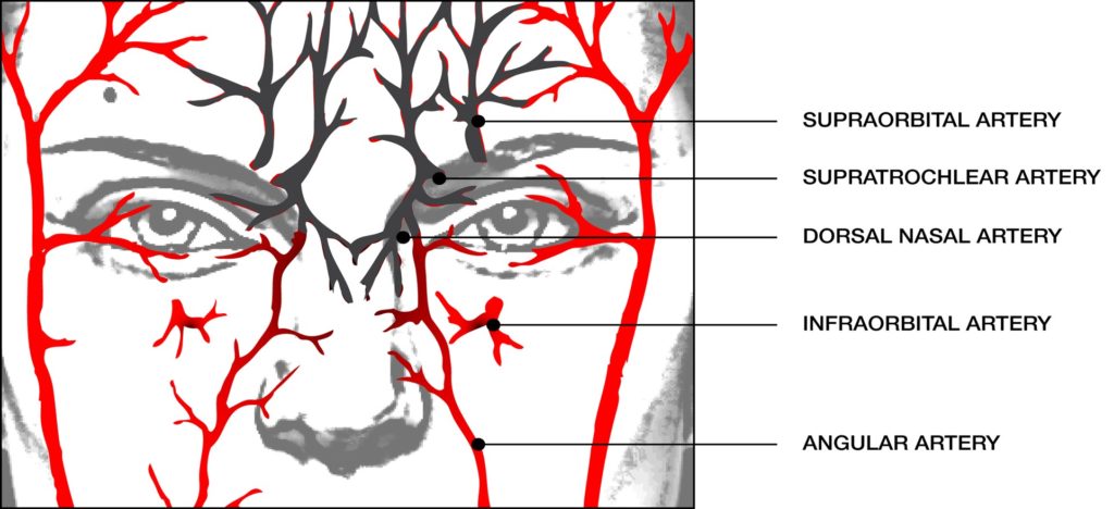 Figure 8. External arterial anatomy of the nose. Vessels originating from the external carotid are in red, whereas those in black come from the internal carotid via the ophthalmic artery.