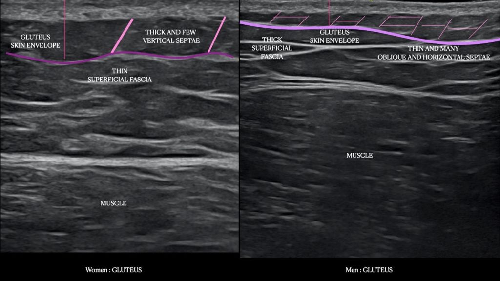 Figure 1 Skin envelope in a. women and b. men